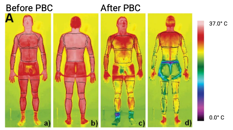 Diagram showing the impact on the body before and after partial body cryotherapy