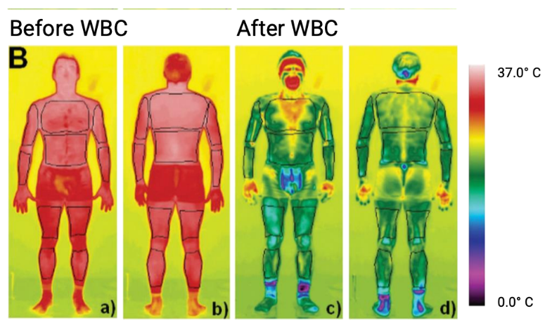 Diagram showing impact on the body before and after whole body cryotherapy